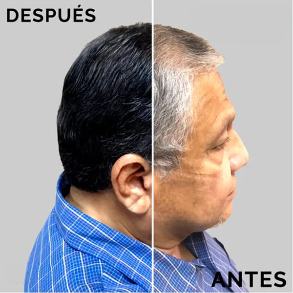 ¡ADIÓS CANAS EN 5 MINUTOS!